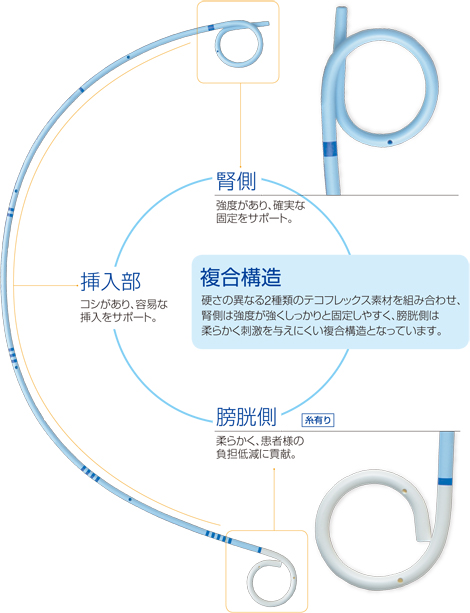 尿管ステント 上部尿路 製品情報 メディカルタウン 泌尿器科 オリンパス